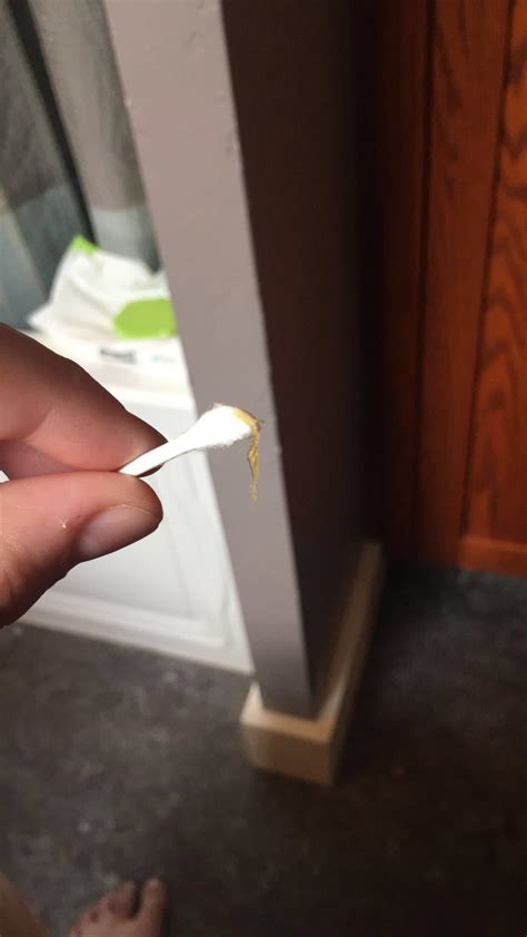 This dry skin came out of my ear. : r/peeling
