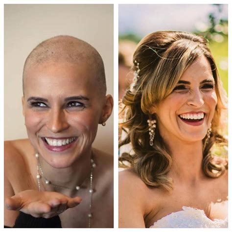 beauty tip  post chemo hair growth