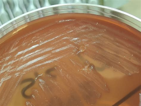 Strep Bacteria In Blood
