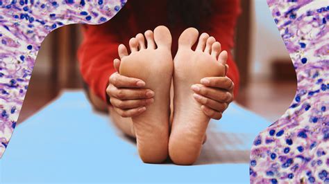 Bob Marley Cancer Toe