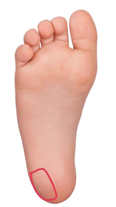 Sharp pain/ dull ache in this area of foot. I got diagnosed with PF