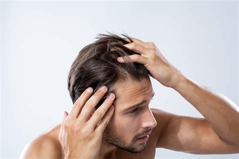 how to tell if hair loss is from stress