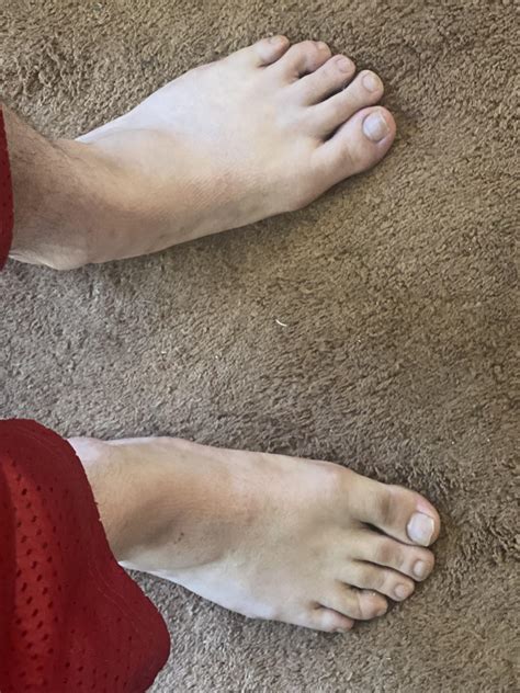 My feet suck : r/BarefootRunning