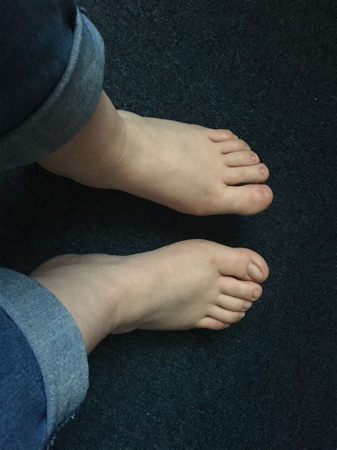 Had my ingrown nail removed 5 and a half years ago. Can’t see any