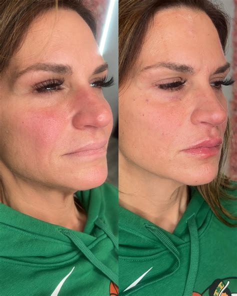 Beyond Beauty Medspa LLP (@beyondbeauty_medspa_) • Instagram photos and