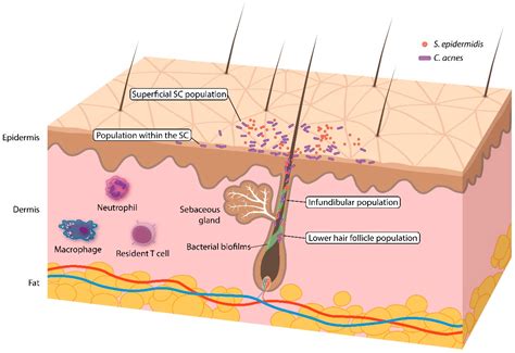 potential role   microbiome  acne  comprehensive review