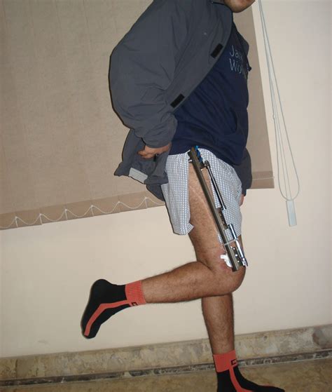 Lengthening Over Nails - cicllr