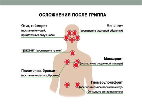 Острые респираторные вирусные инфекции - презентация онлайн