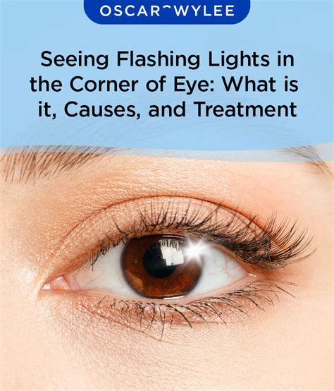 Seeing Flashing Lights in the Corner of Eye: What is it, Causes, and