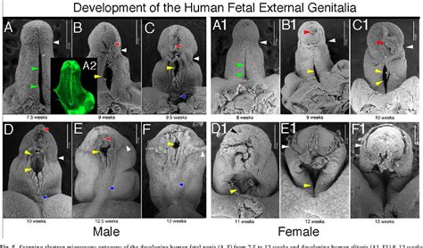 figure   development   human penis  clitoris semantic