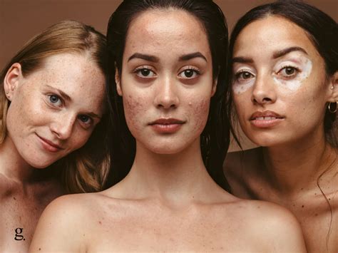 combination skin guide   identify care   unique skin