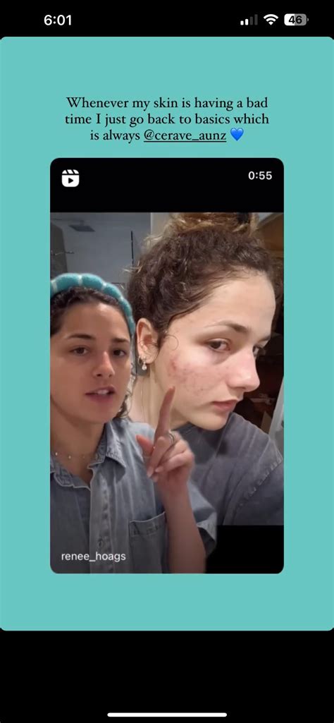 renee’s back at it again : r/HoganTwins