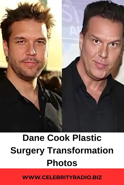 Dane cook plastic surgery before and after photos – Artofit