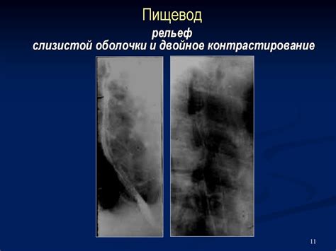 Рентгенологические методы исследования органов брюшной полости ...