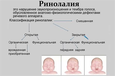 Ринолалия: причины, симптомы, диагностика и лечение