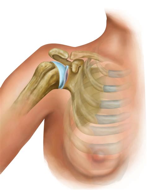 Right Shoulder Injury to Glenoid Labrum :: Behance