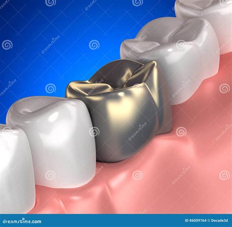 La Pista De Los Dientes De Oro 1