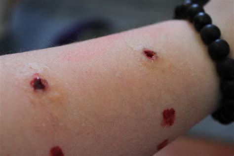 wolf bite  wolf bites  ginevraturner  deviantart