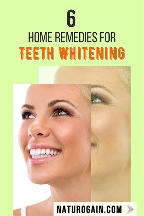 6 Home Remedies for Teeth Whitening to Get Rid of Yellow Teeth