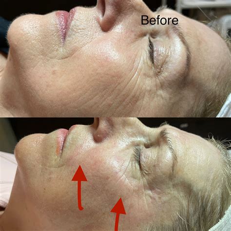 Anti-Aging Techniques That Actually Work - Tropical Esthetics