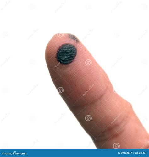 Finger bruise stock image. Image of wounded, injury, pain - 89832587