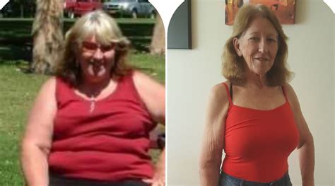 Annette’s Amazing Transformation - District Gazette