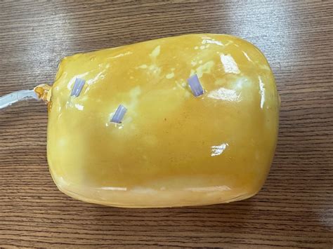 An Ultrasound Training Tool for Removing Kidney Stones