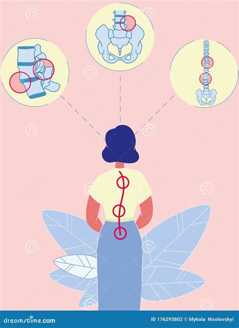 Cartoon Woman Standing Back with Spinal Curvature Stock Vector