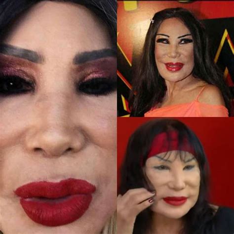 Lyn may before plastic - twoQas