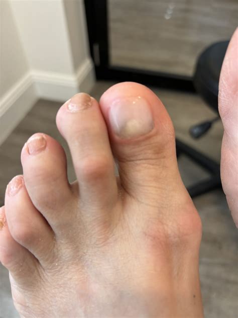 Professional Podiatry Services | Sports Medicine Clinic Parramatta