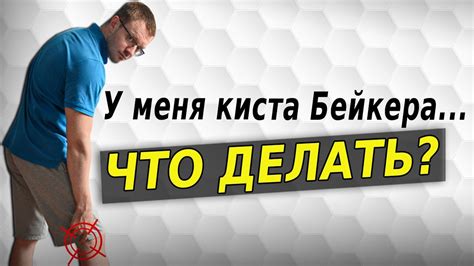 Киста Бейкера. Упражнения. - YouTube