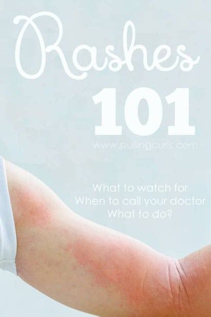 Skin Rashes 101