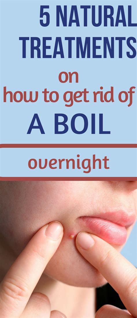 What’S The Cure For Boils : How to Get Rid of a Boil At Home: 5 Steps