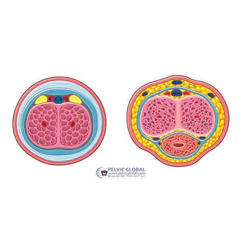 Clitoris and Penis Anatomy, Comparative, Analogous, Cross Sections