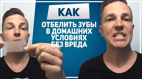 ОТБЕЛИВАНИЕ ЗУБОВ. Отбеливание зубов в домашних условиях. Как отбелить ...