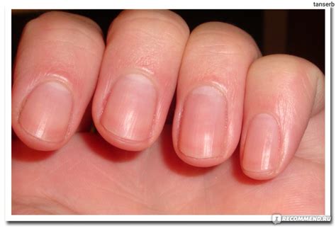 Гель для удаления кутикулы Sally Hansen - «На данный момент лучший ...