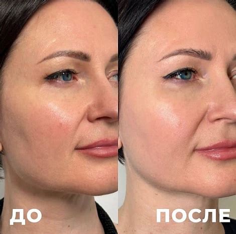 Ретинол для лица: как выбрать косметику с ретинолом? - ООО Инновация