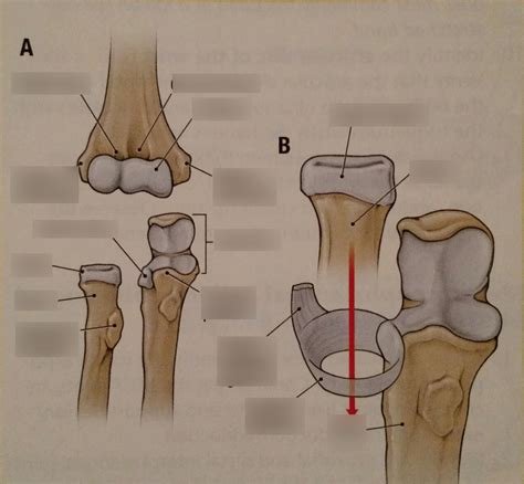 Dissector | Week 4 Elbow anterior view, annular ligament Diagram | Quizlet