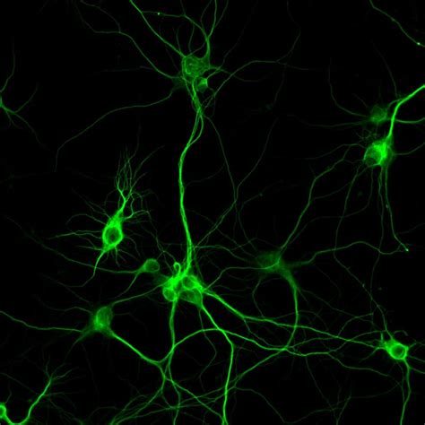primary neuron   rat cortex supplied  transnetyx tissue
