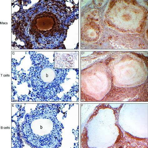 Morphometric analysis of lung granulomas elicited by different ...