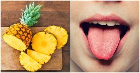 5 Symptoms To Unmask A Pineapple Allergy
