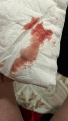 Estou Gravida E Estou Sangrando - Estou sangrando gravide de 6 semanas | BabyCenter