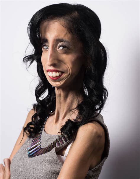 The Last Tradition World S Ugliest Woman Lizzie Velas - vrogue.co