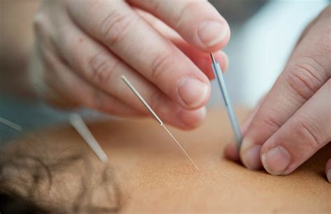 Pain Management, Holistic Therapies: From Acupuncture To CBD - Holistic