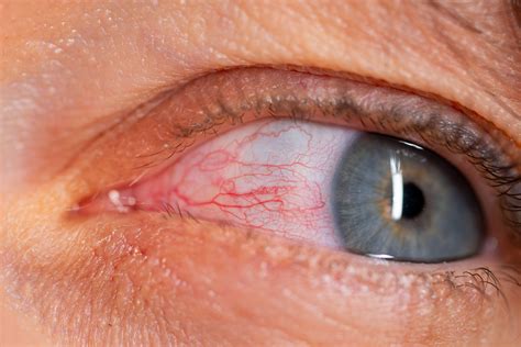 Experts reveal the hidden health side effects of lash serums | The