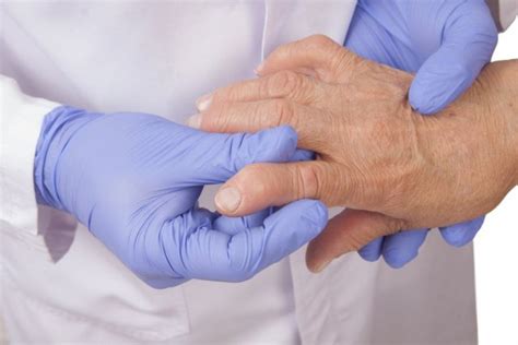 Ревматизм: самые главные факты | MedAboutMe