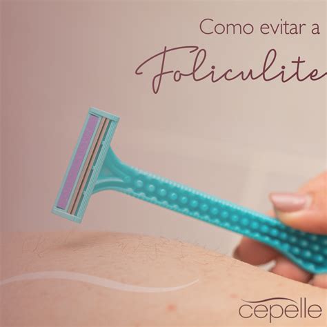Como Evitar A Foliculite - Como evitar a foliculite - Cepelle Dermatologia | Curitiba