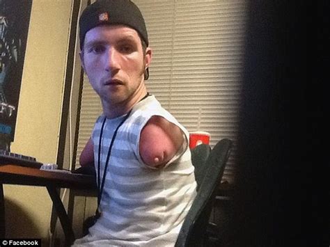 video gamer   arms  legs winning competitions daily mail