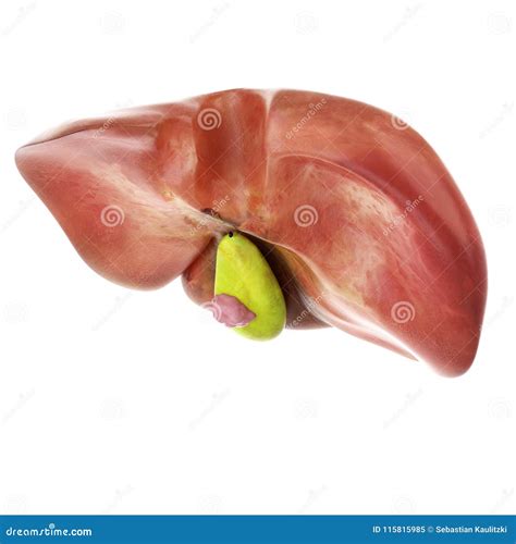 Gallbladder Cancer Infographic In Flat Design. Gallbladder Cancer