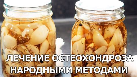 Лечение остеохондроза народными методами - YouTube